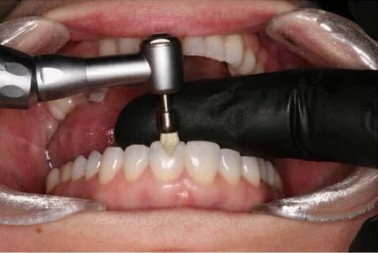 Waldent Nitrile Examination Gloves- Black (Pack of 80)