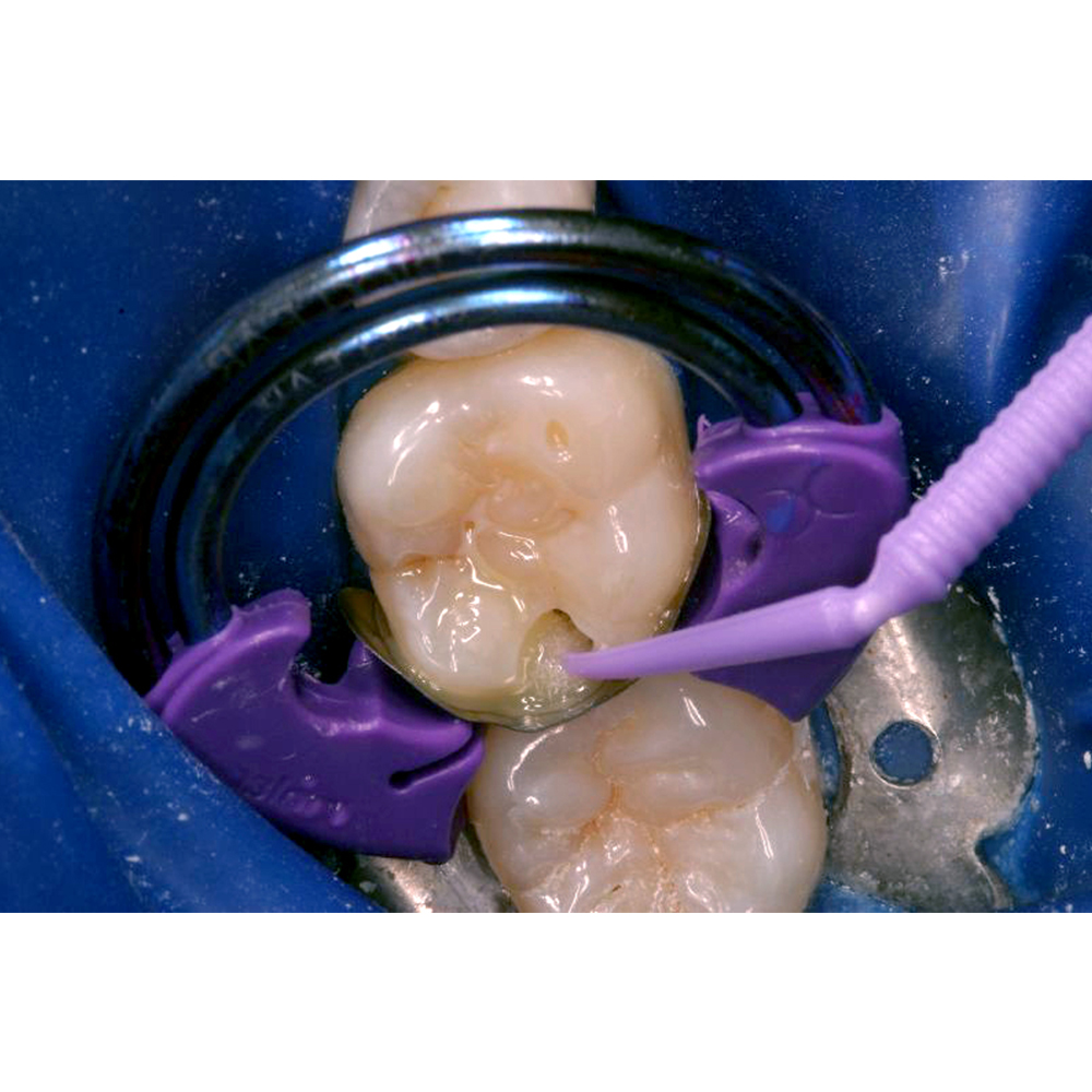 Prevest Denpro Crysta Dentin Conditioner (30021)