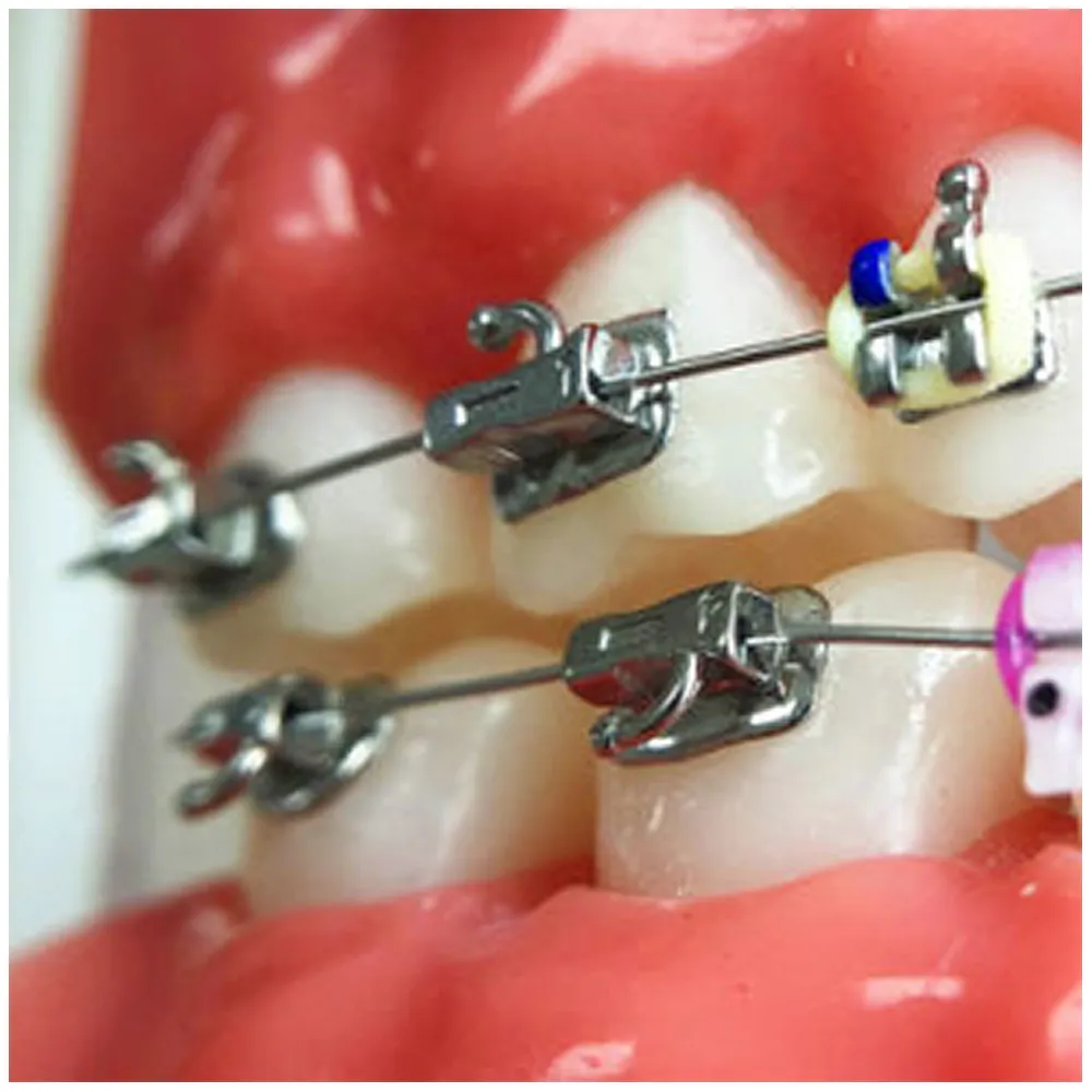 Koden 1st Molar Bondable Buccal Tubes (Pack of 4)