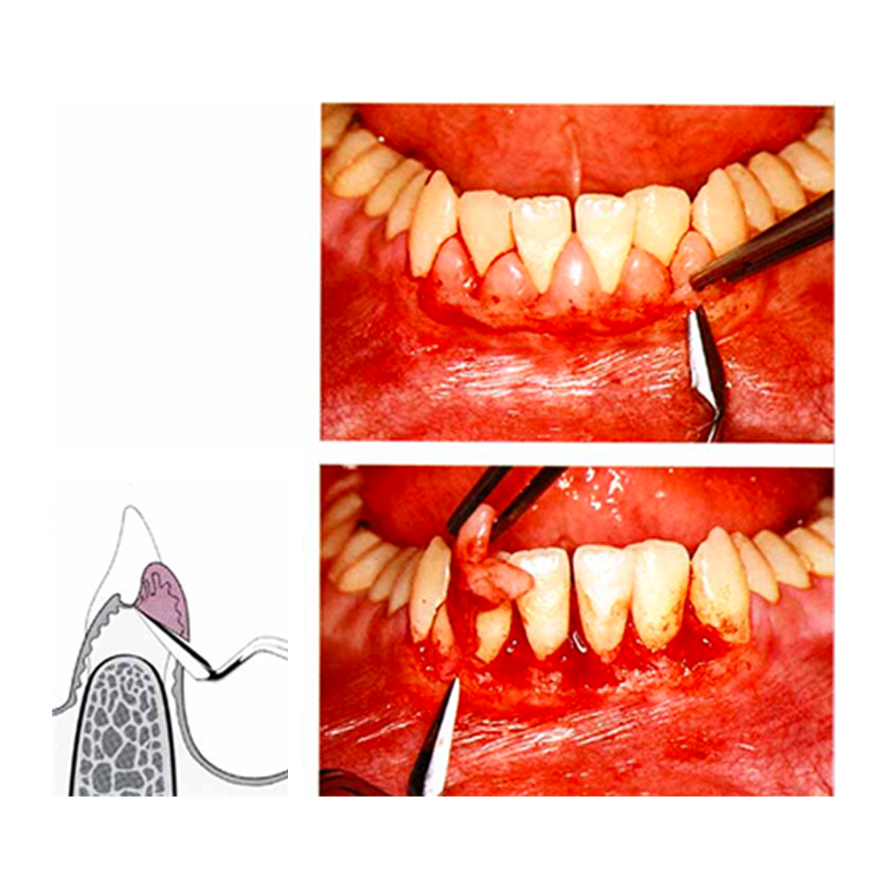 GDC Buck Knife #6 (Kb5/6)