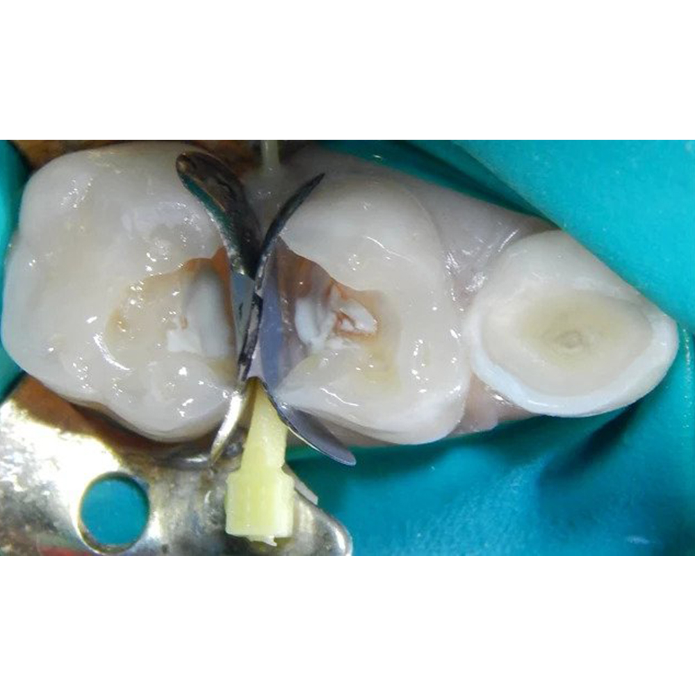 Prevest Denpro CalUltra (40046)