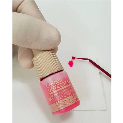 Kuraray Caries Detector