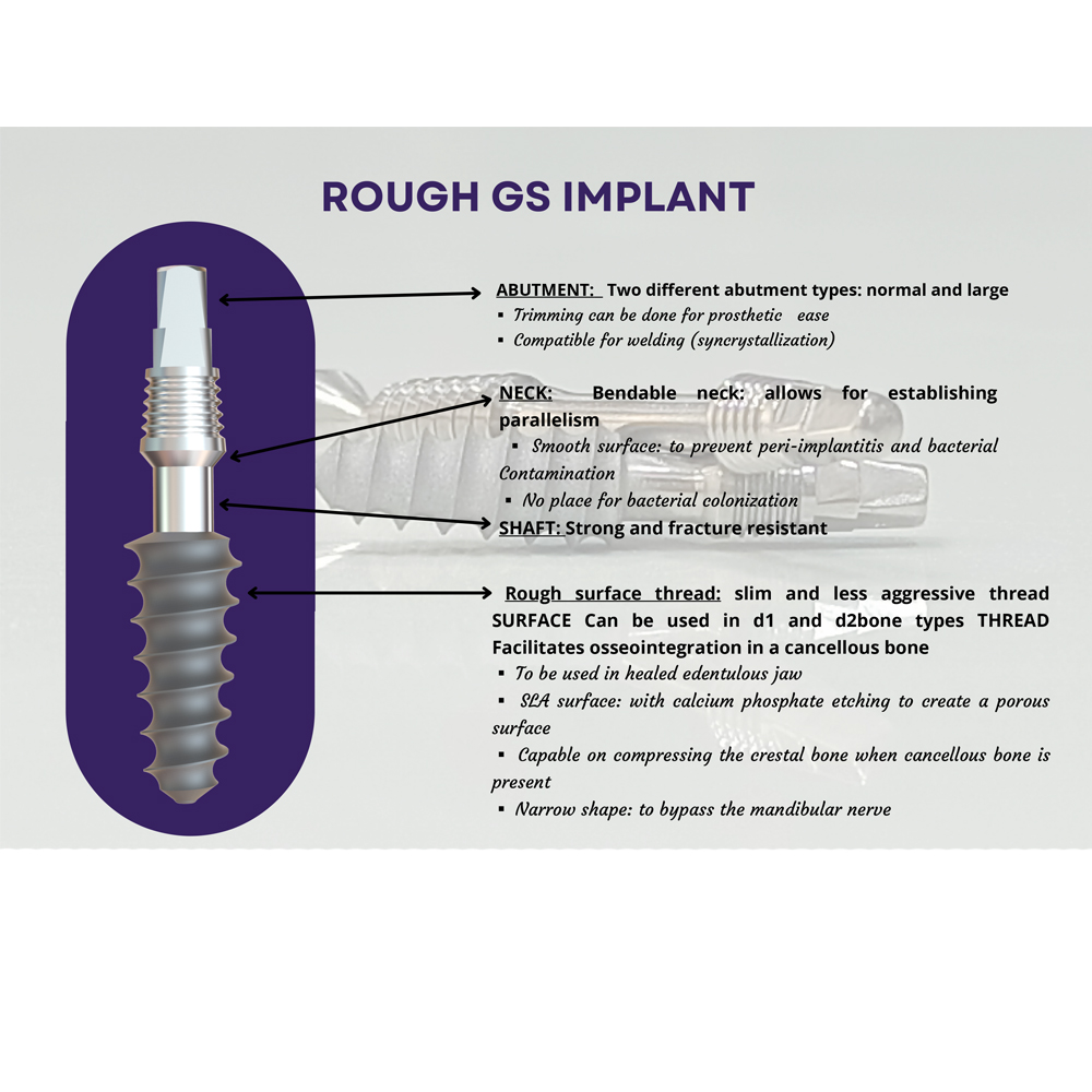 GS Implants Rough 3.7mm