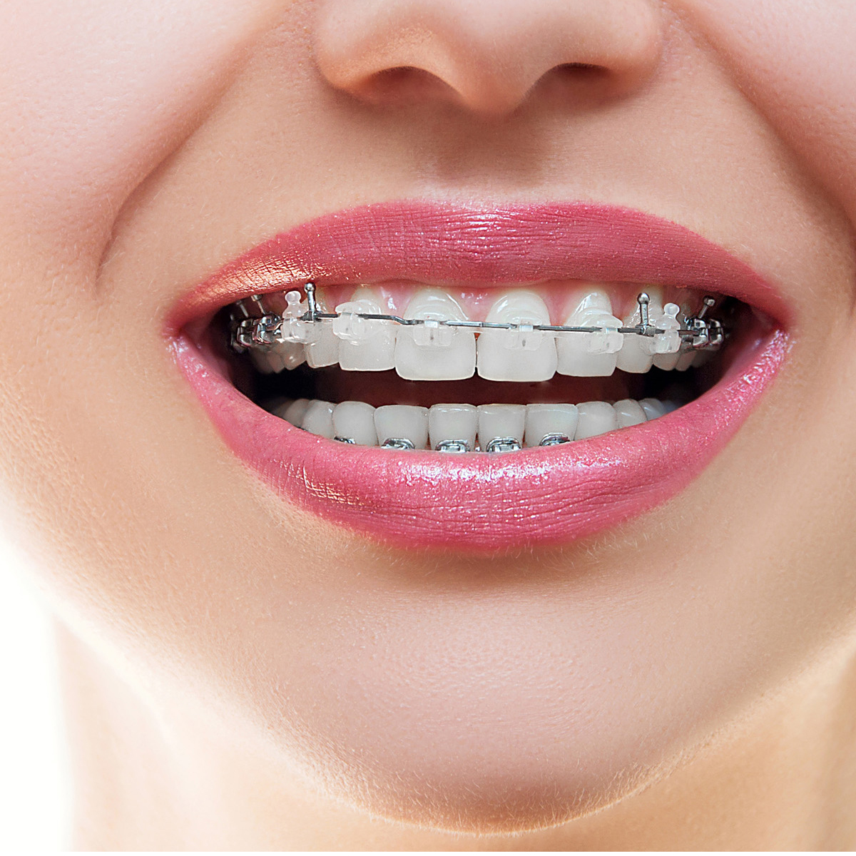 JJ Ortho Superelastic NiTi Archwires Natural Form - Round 