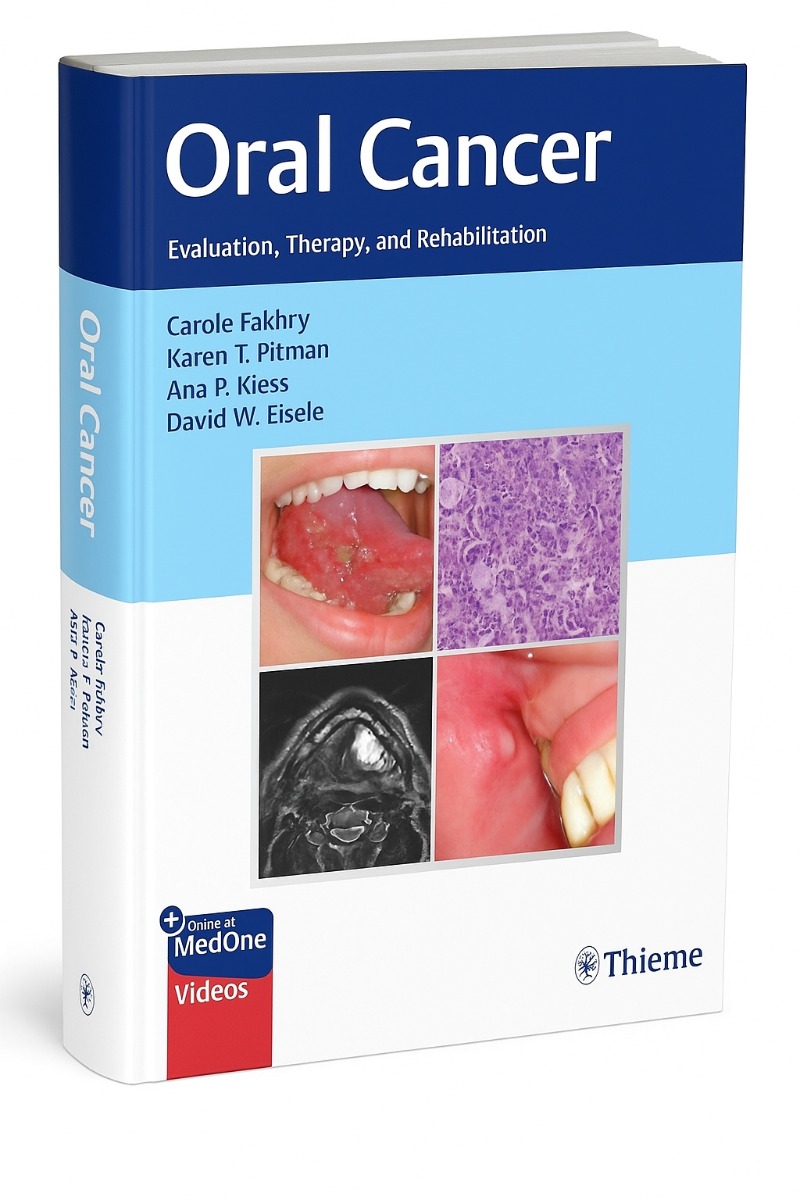 Oral Cancer: Evaluation, Therapy & Rehabilitation 1st Edition (ISBN - 239685)