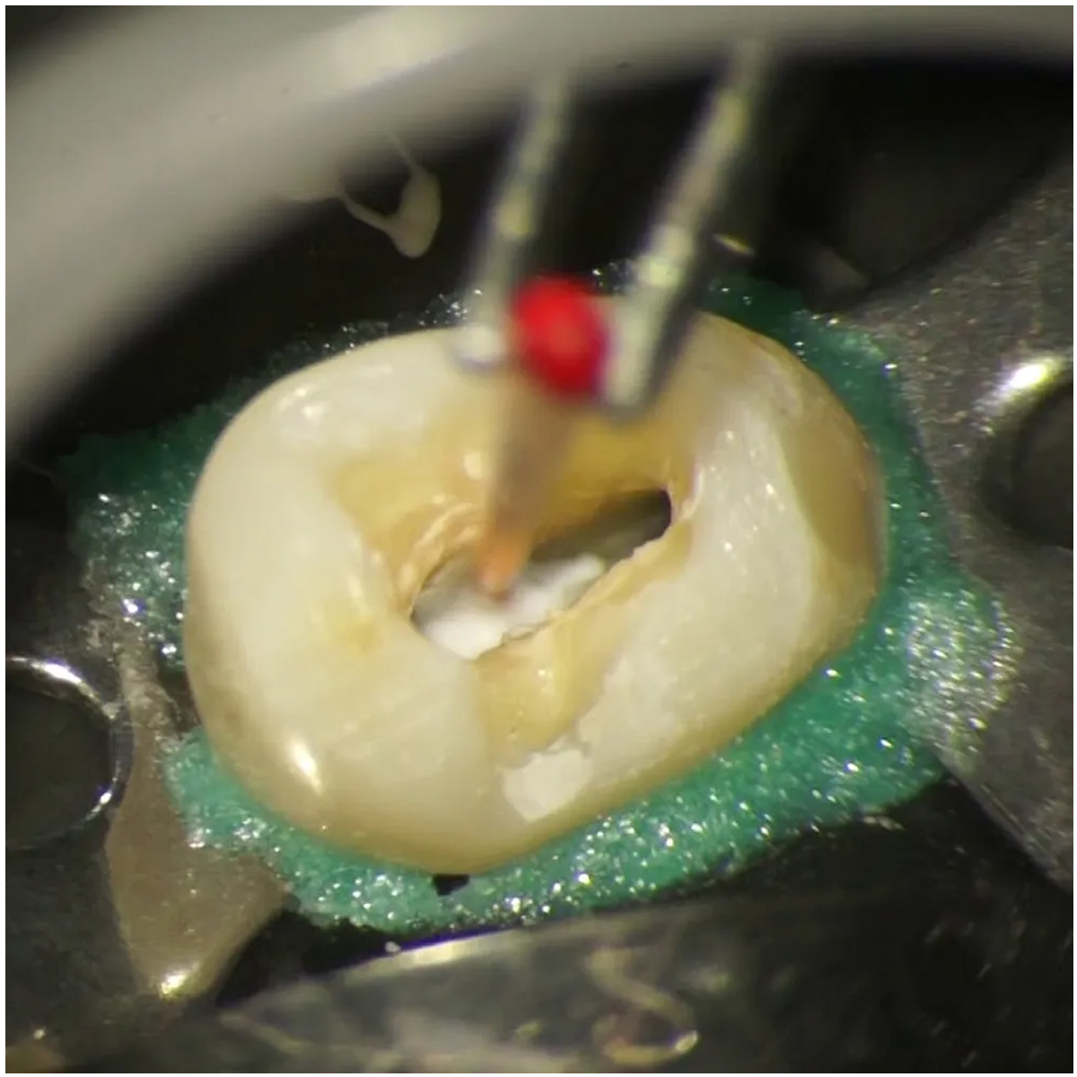 Cerkamed Calcipast Calcium Hydroxide Paste (Radiopaque)