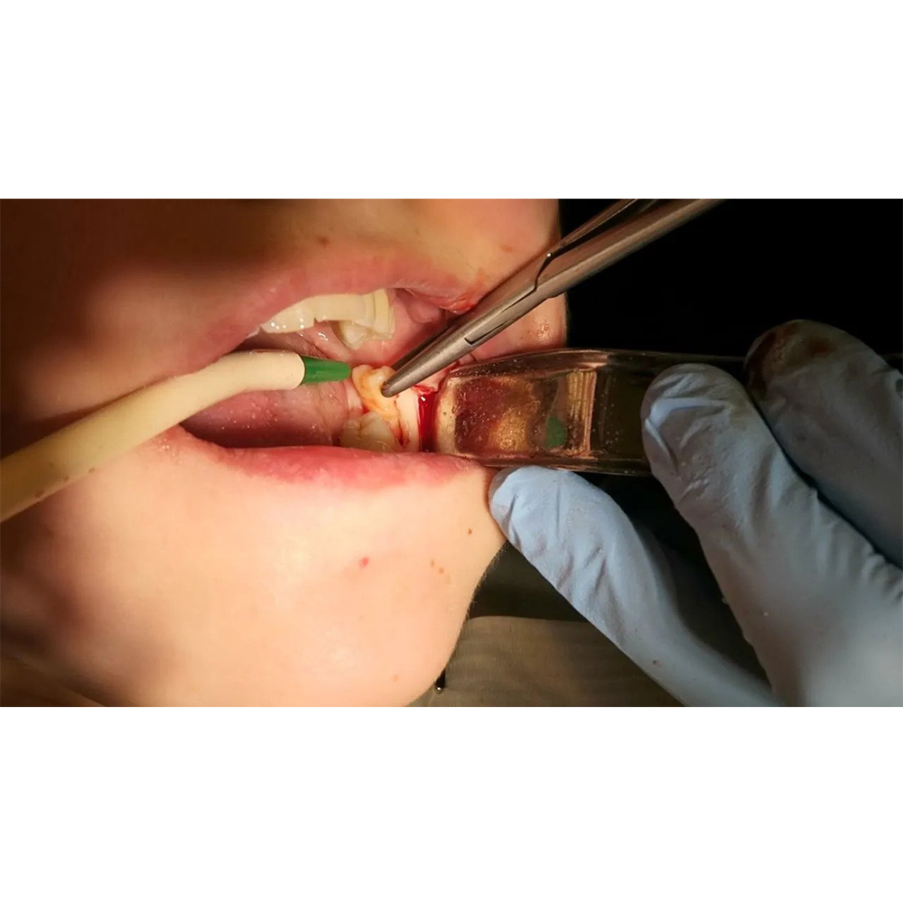 GDC Austin Cheek Retractors