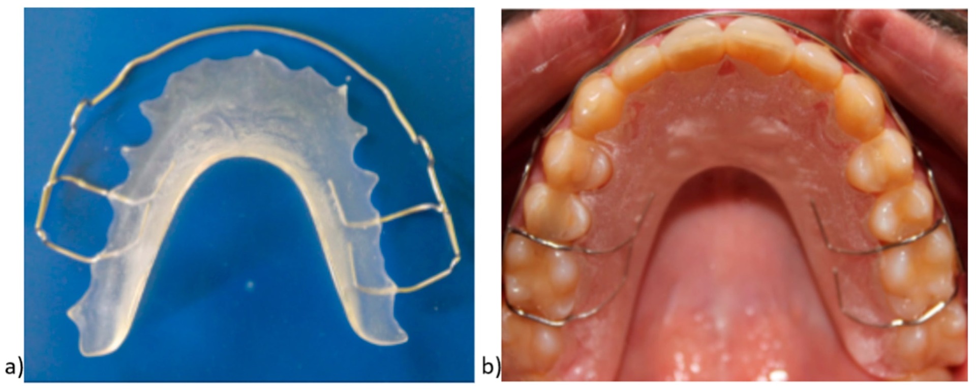 Dentaurum Orthocryl EQ Powder Polymer Clear 1 Kgs - 160-300-00