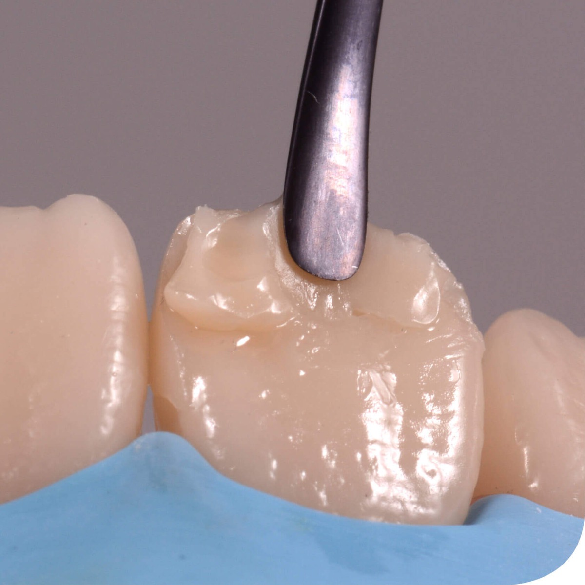 GDC Filling Instruments Set Of 12 Instruments Kit (FIS12)