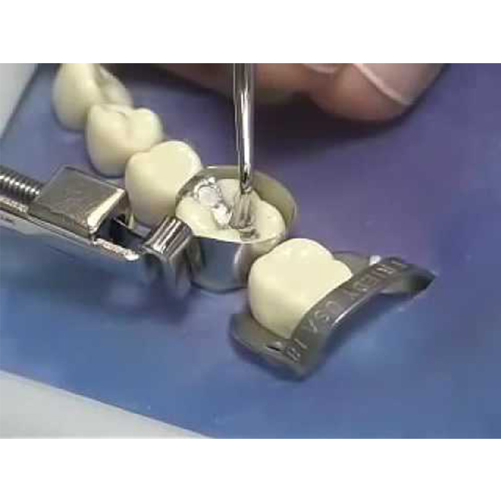 GDC Plastic Filling Instrument - 3 (PFGFT1)