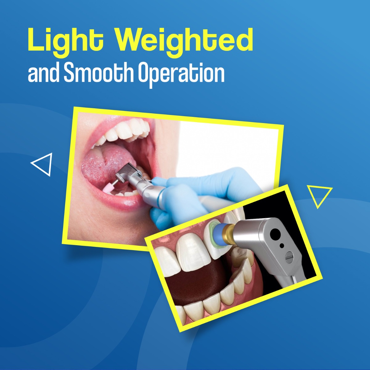 Waldent Contra-angle Handpiece Special Edition (W-141)