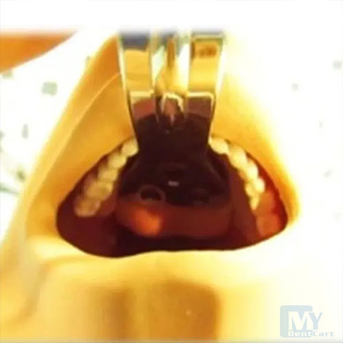 Oracraft Weider Cheek & Tongue Depressor