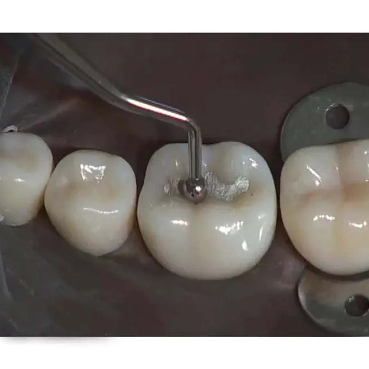 Oracraft Ball Burnisher #3 -BB22/23