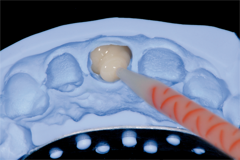 3M ESPE Mixing Tips (Blue) Pack Of 8