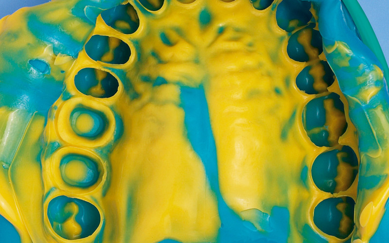 Prevest Denpro Accusil Combo Kit (70004-1)