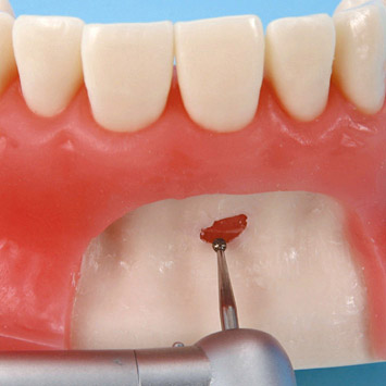 iDENTical Oral Surgery Training Model M4026