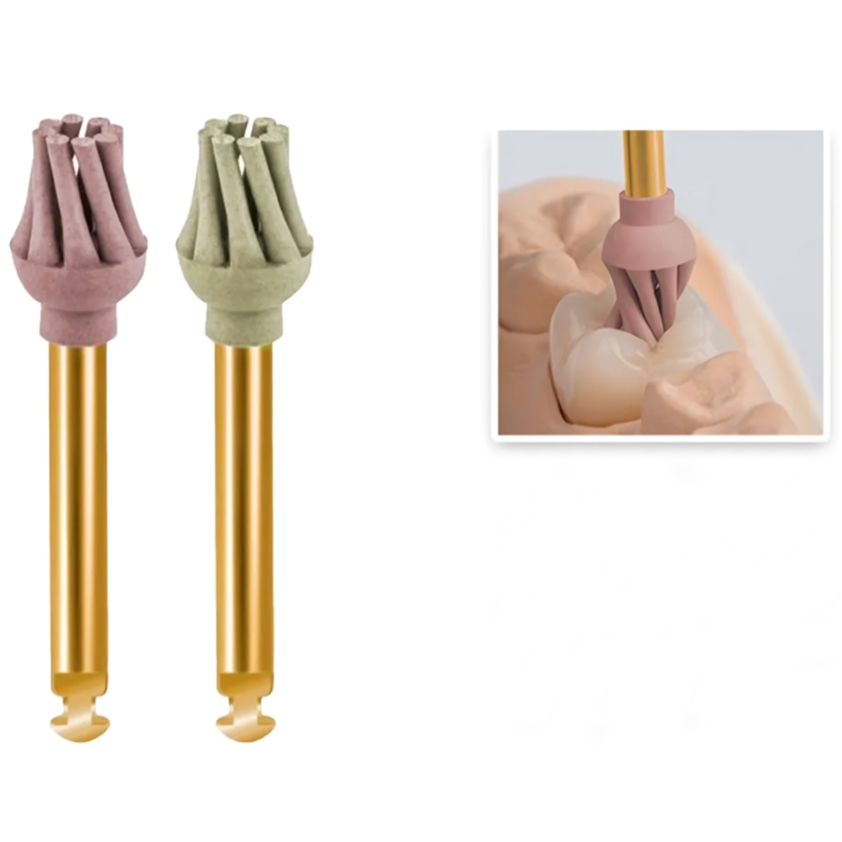 Youdent 2 Step Composite Polishing Assorted Kit RA