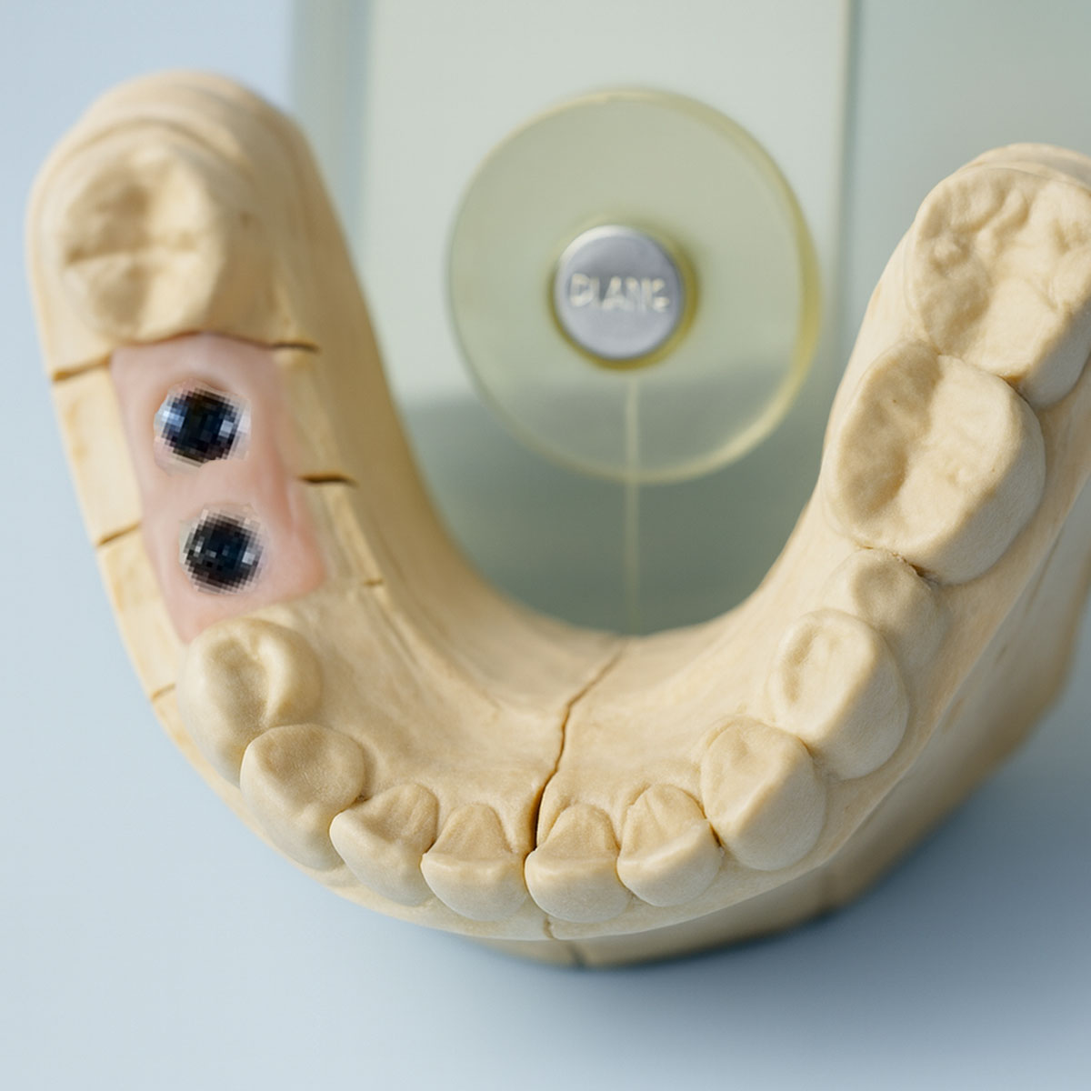 Dentaltech Israeli Implant Compatible Lab Analog