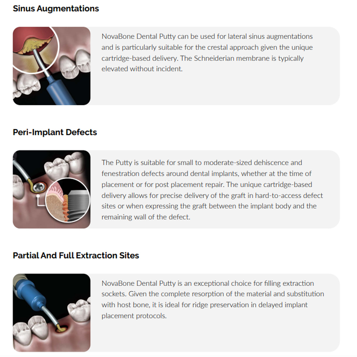 Novabone Dispensing Gun For Bone Graft Putty Cartridge