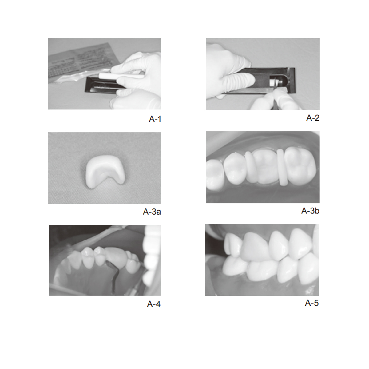 GC Revotek Lc Intro Set