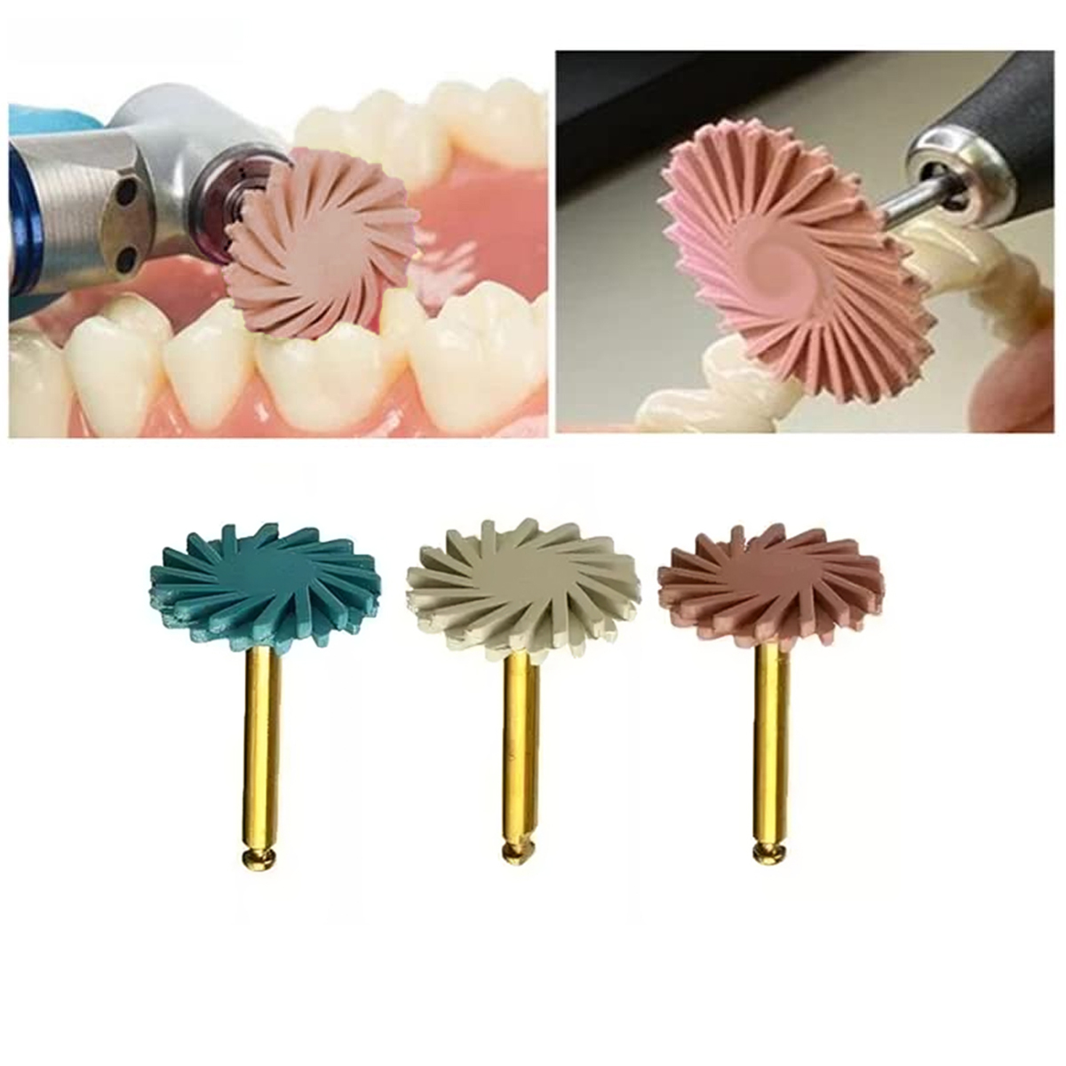 Youdent 3 Step Universal Polishing Kit Assorted RA