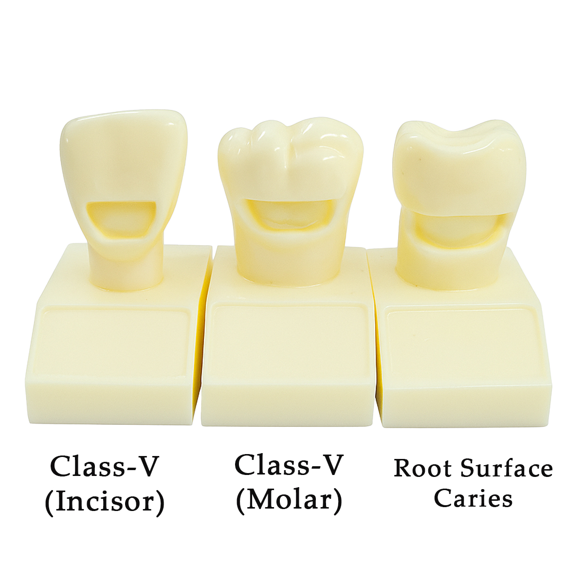 IDENTical Cavity Demonstration Model For Pre - Clinical Training 4X Size - Set of 12 M7025