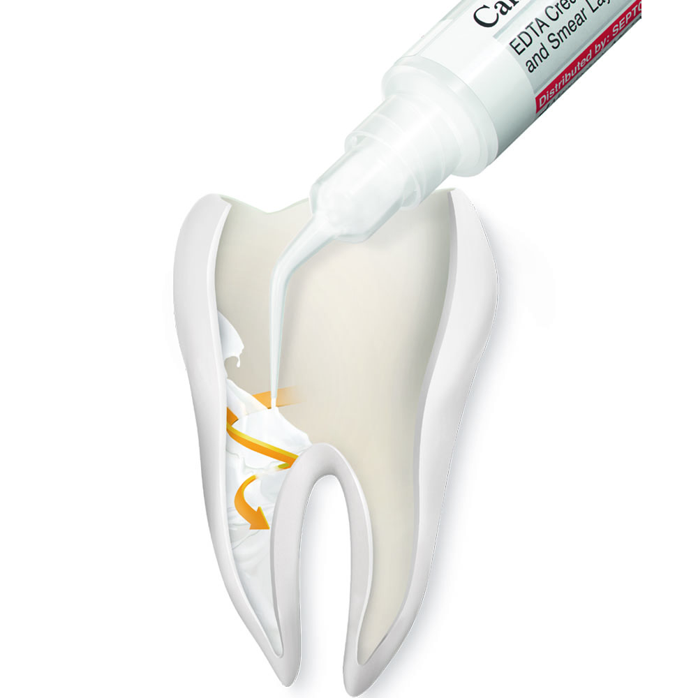 Septodont Canal + (Short Expiry 07-2026)