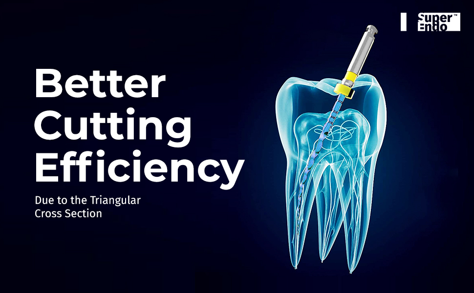 SuperEndo Blue Files 21mm (Pack of 6)