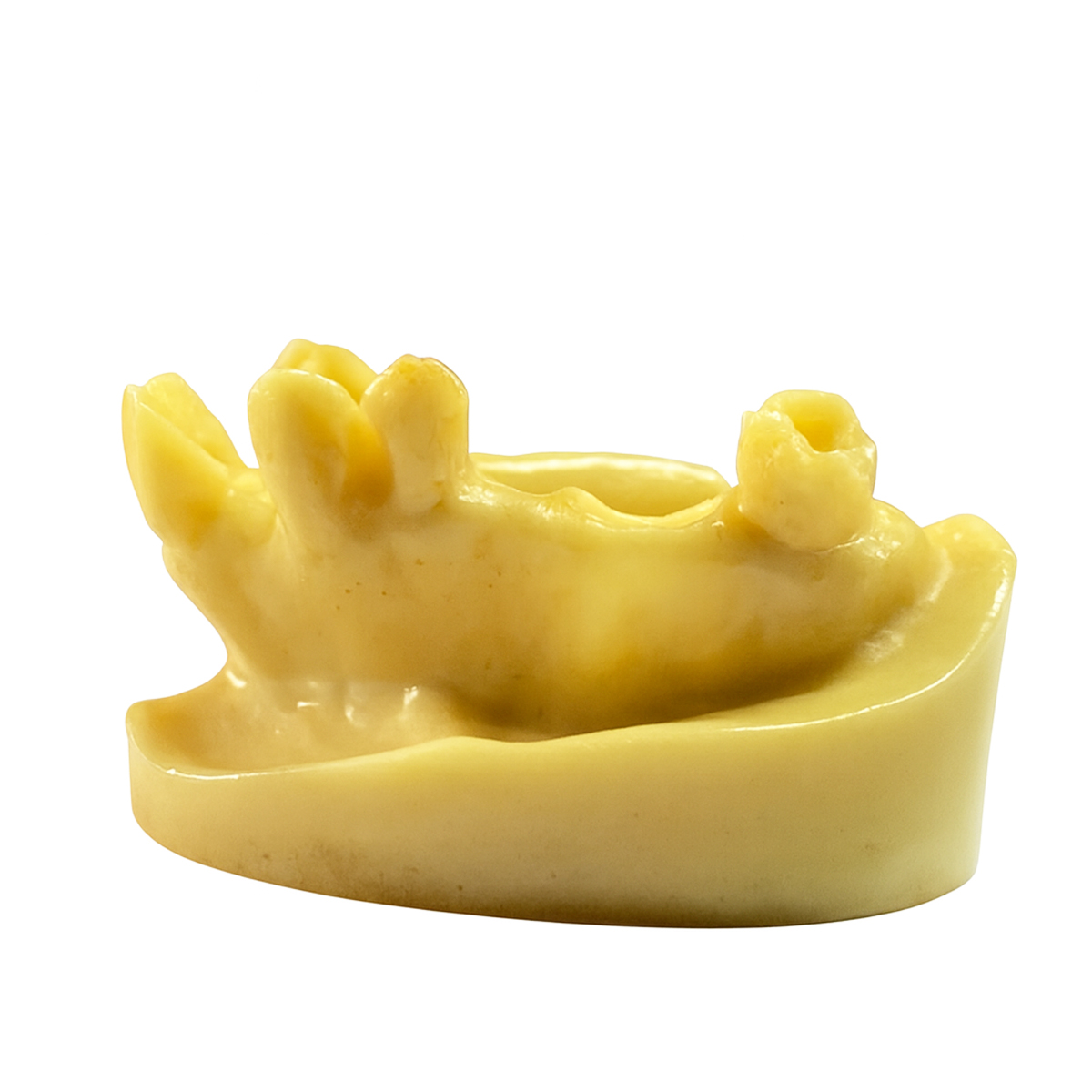 iDENTical Implant Practice Model With Extraction Sockets M2045