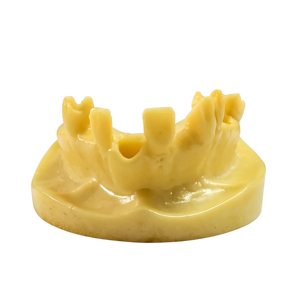 iDENTical Implant Practice Model With Extraction Sockets M2045