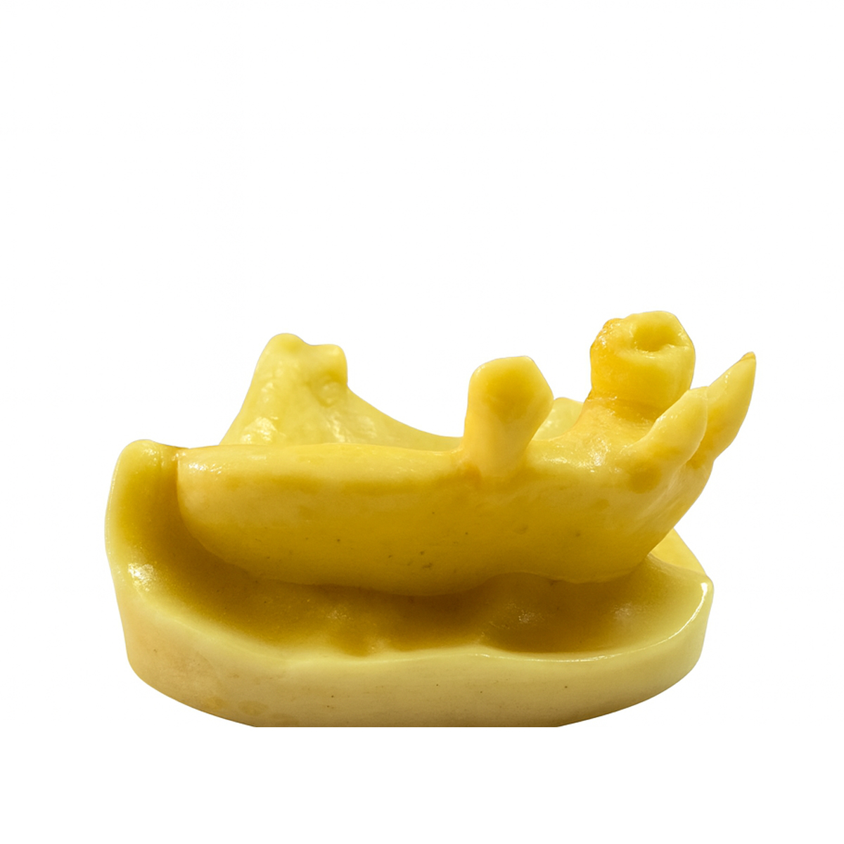 iDENTical Implant Practice Model With Extraction Sockets M2045