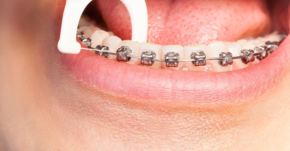 Stim Flosal (Pack Of 10)