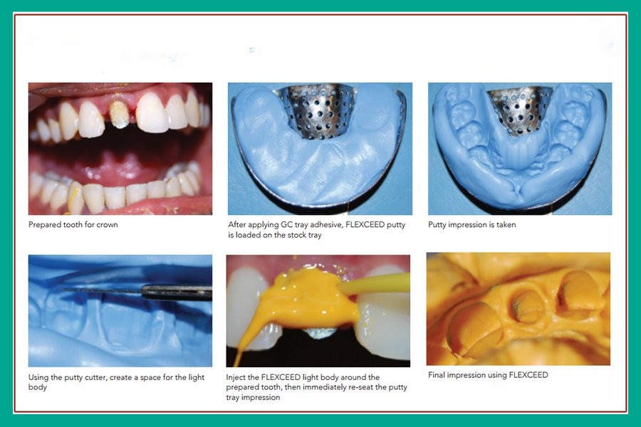 GC Flexceed Putty + Light Body Kit