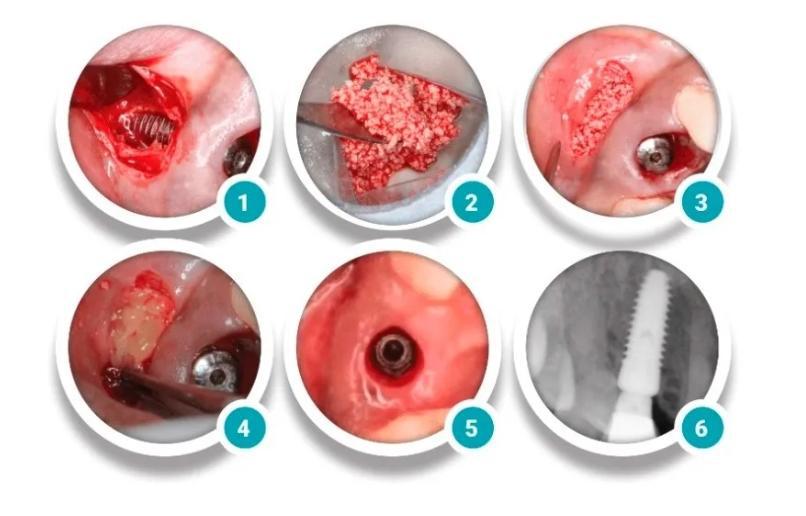 Novabone Dental Morsel - 0.5cc