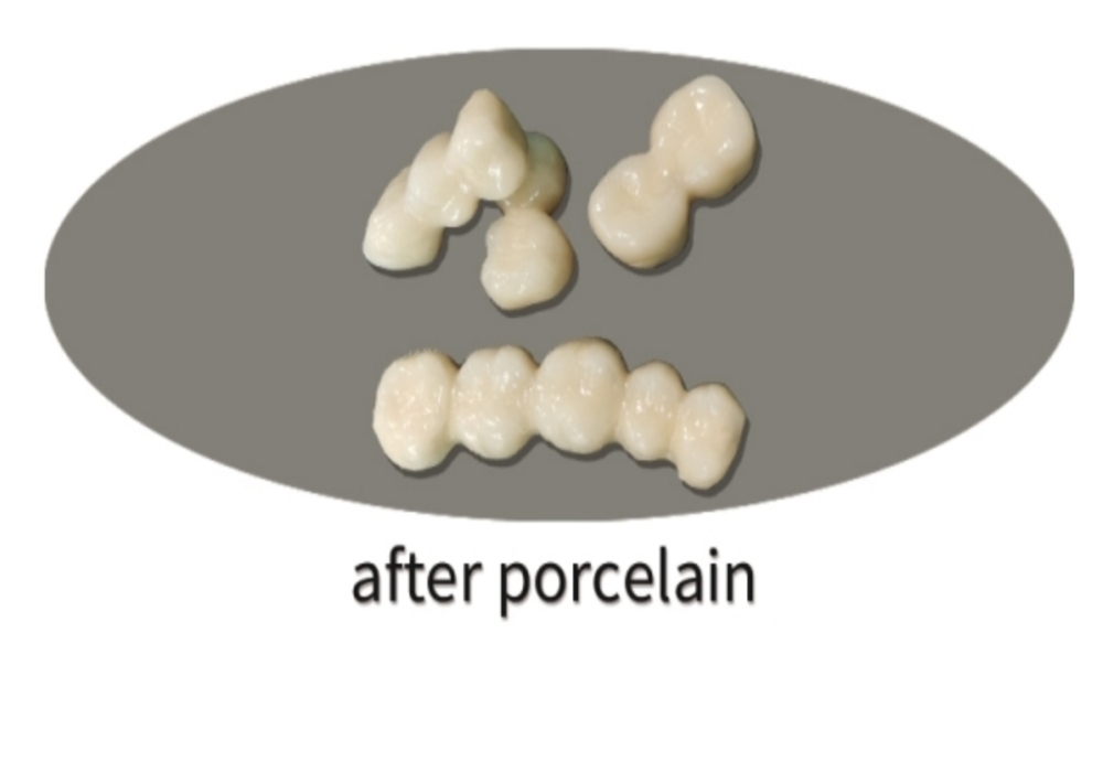 Labodent Nickel Chromium Alloy Powder (10-30μm) - 5Kg