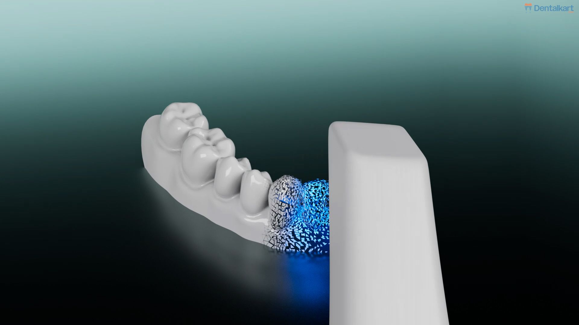 Waldent BLZ IntraVue 900 Ai Intraoral Scanner | Call +91-9311803455 For Easy Finance Options