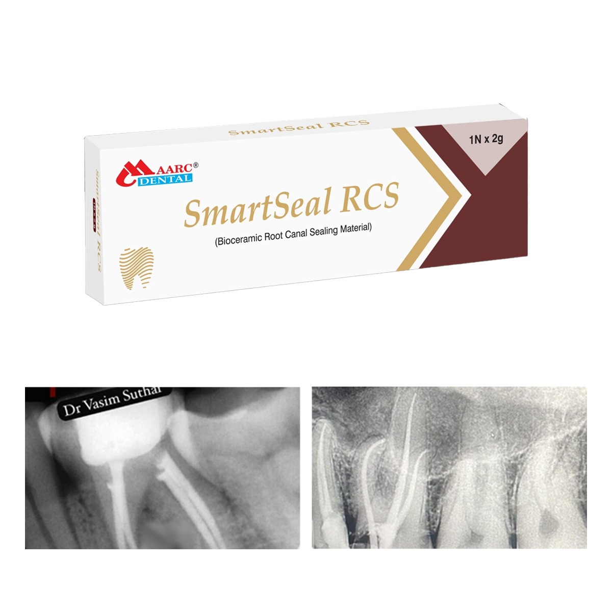 Maarc SmartSeal RCS Bioceramic Root Canal Sealing Material