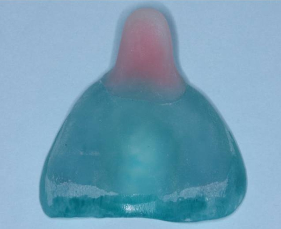 DentAct Pattern Cure Light Cure Pattern Resin