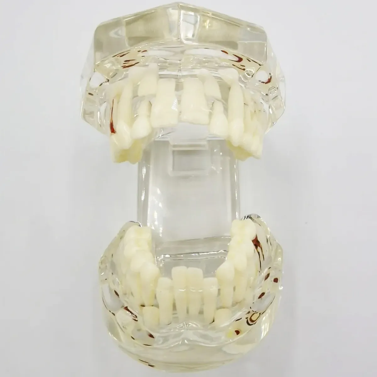 iDENTical Mixed Dentition Model M7015