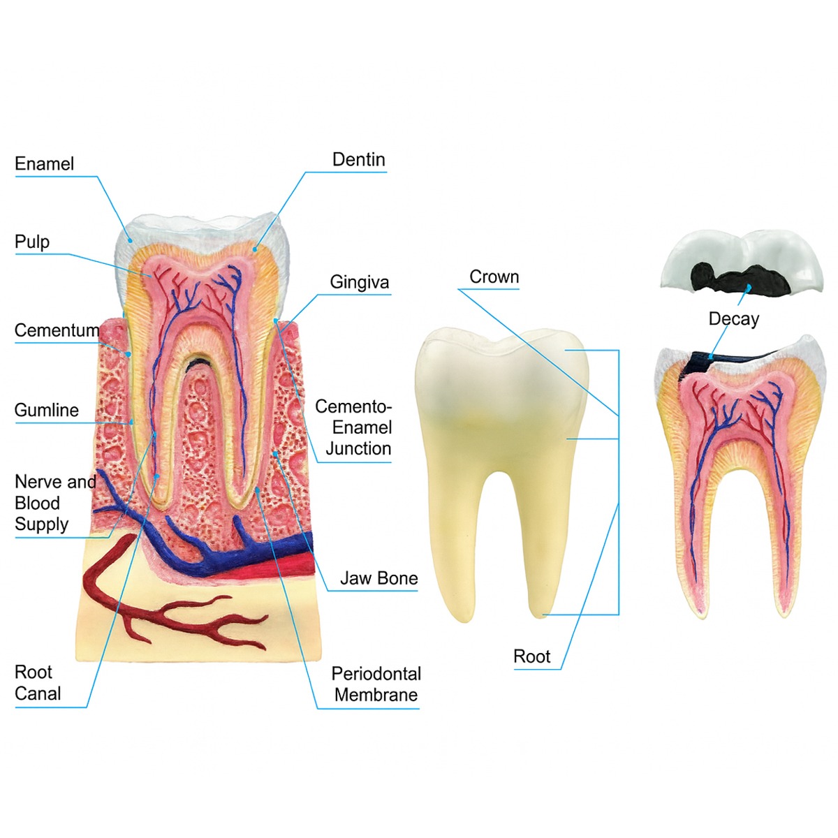 iDENTical Anatomical 3D Molar Model Colored M7036