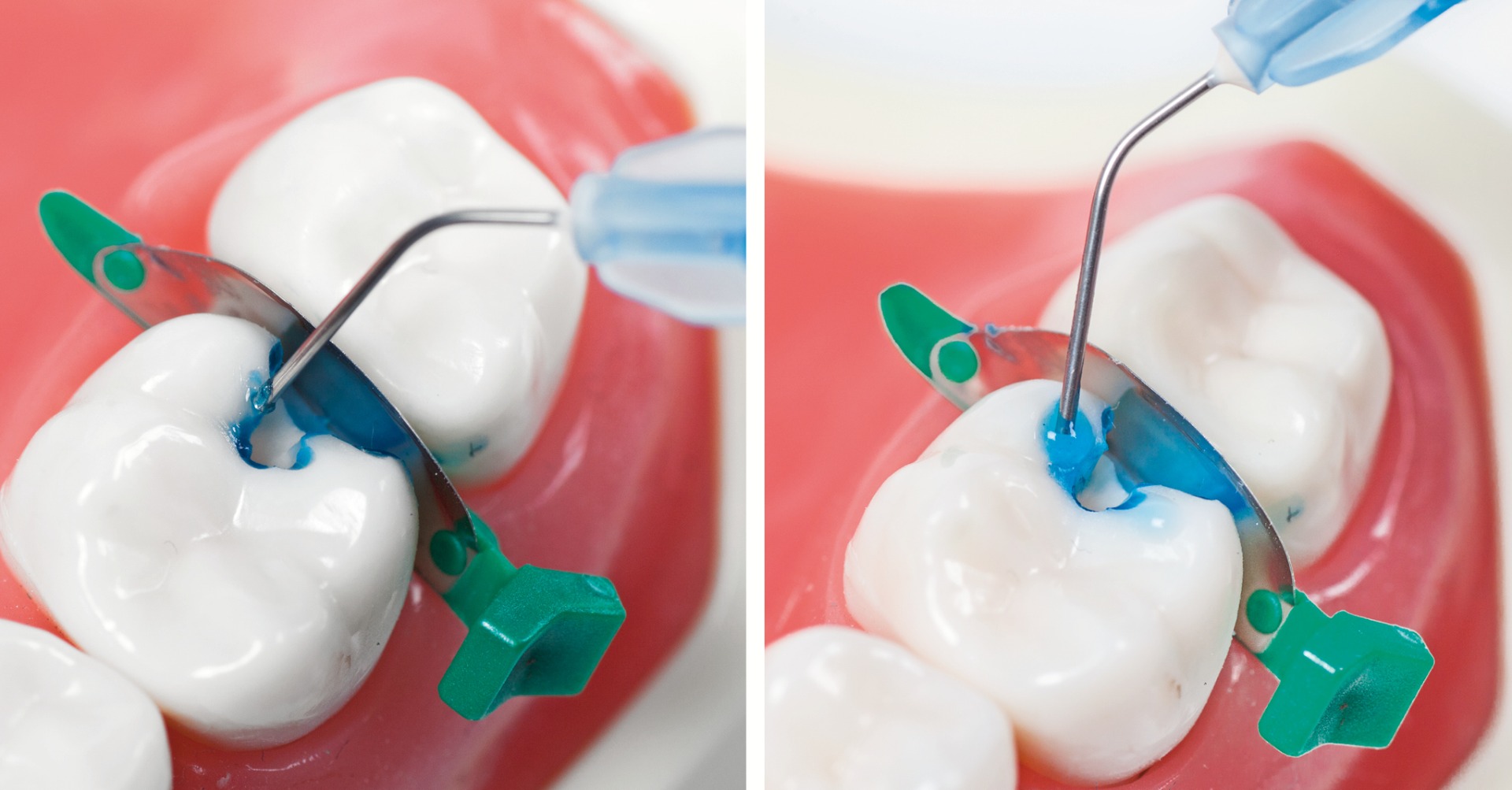 Vishal Dentocare V ‐ File Gel (Short Expiry 07-2026)