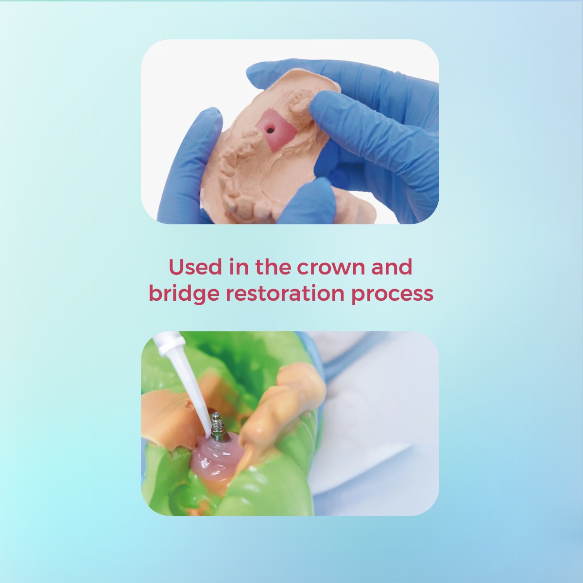 Waldent FlexiGum Gingival Mask (50mlx2) (Short Expiry 05-2026)