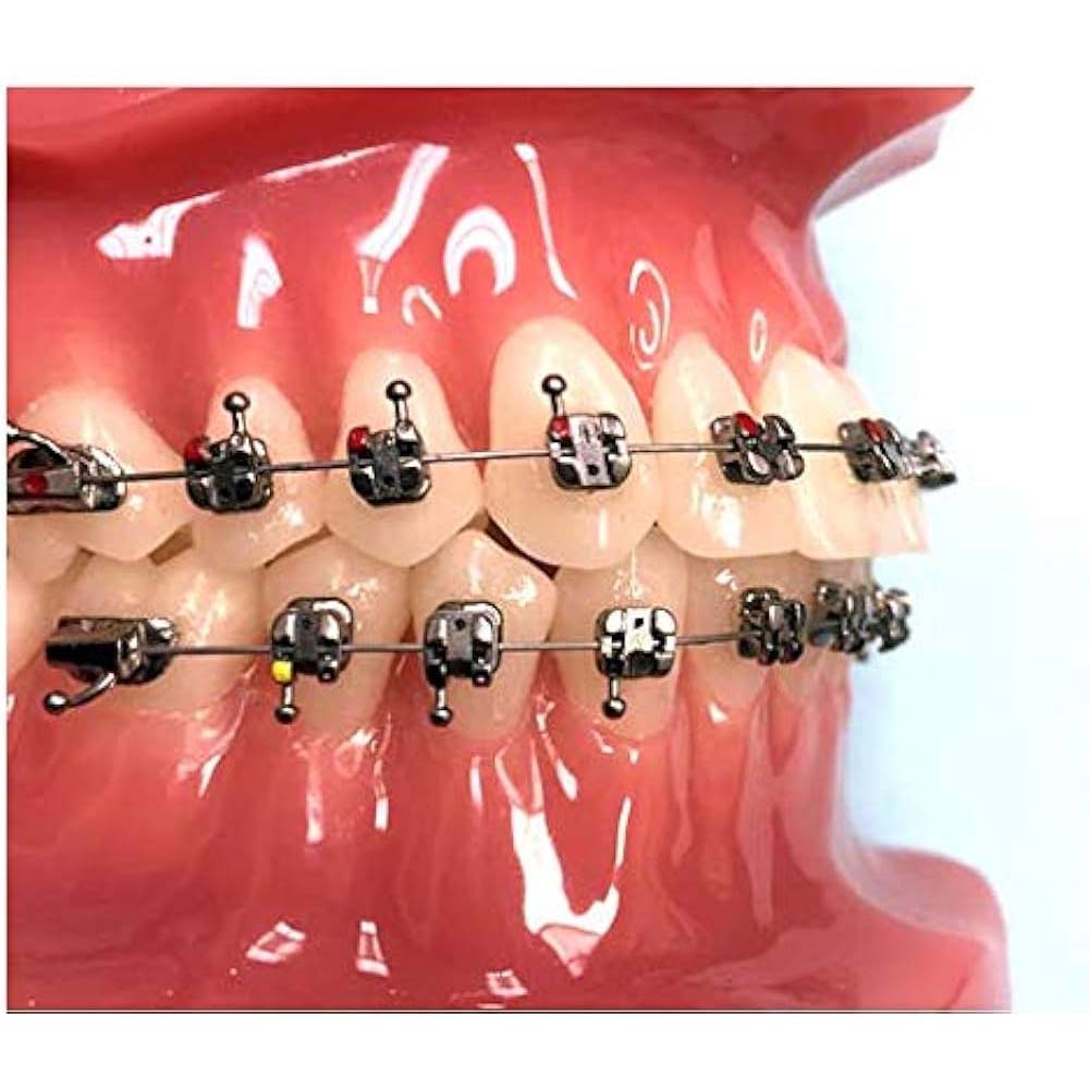 Morelli Max Bracket Kit MBT 022 With Hook 345 - Max with Hooks