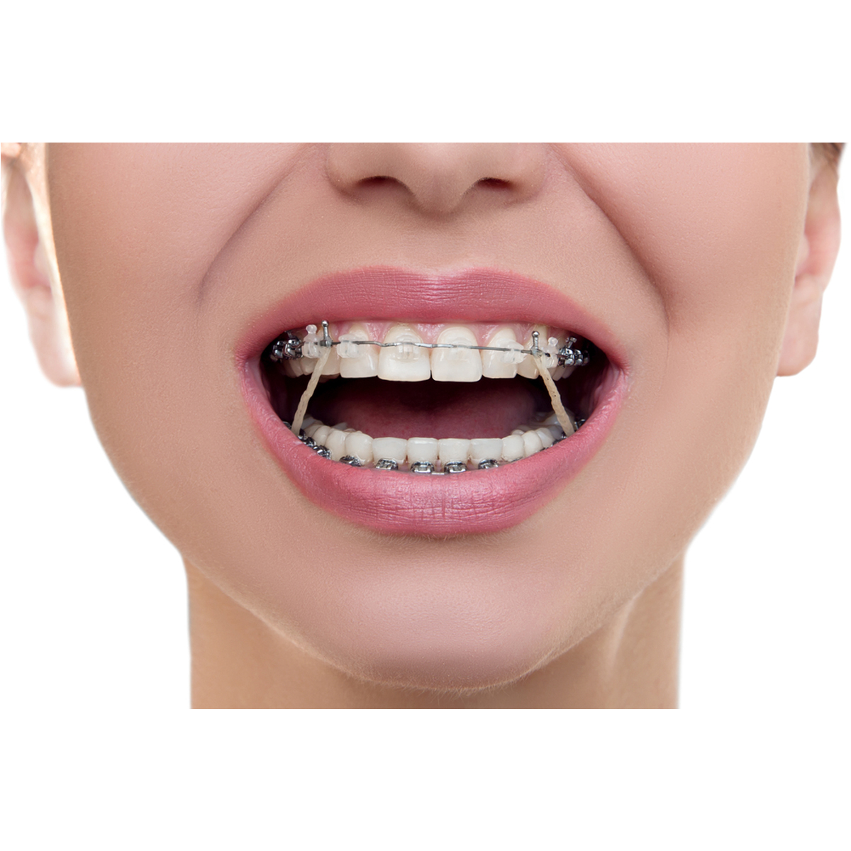 TP Ortho Plain Latex Tooth Colour Elastics White 1/8" - 2 Oz (Short Expiry 03-2026)