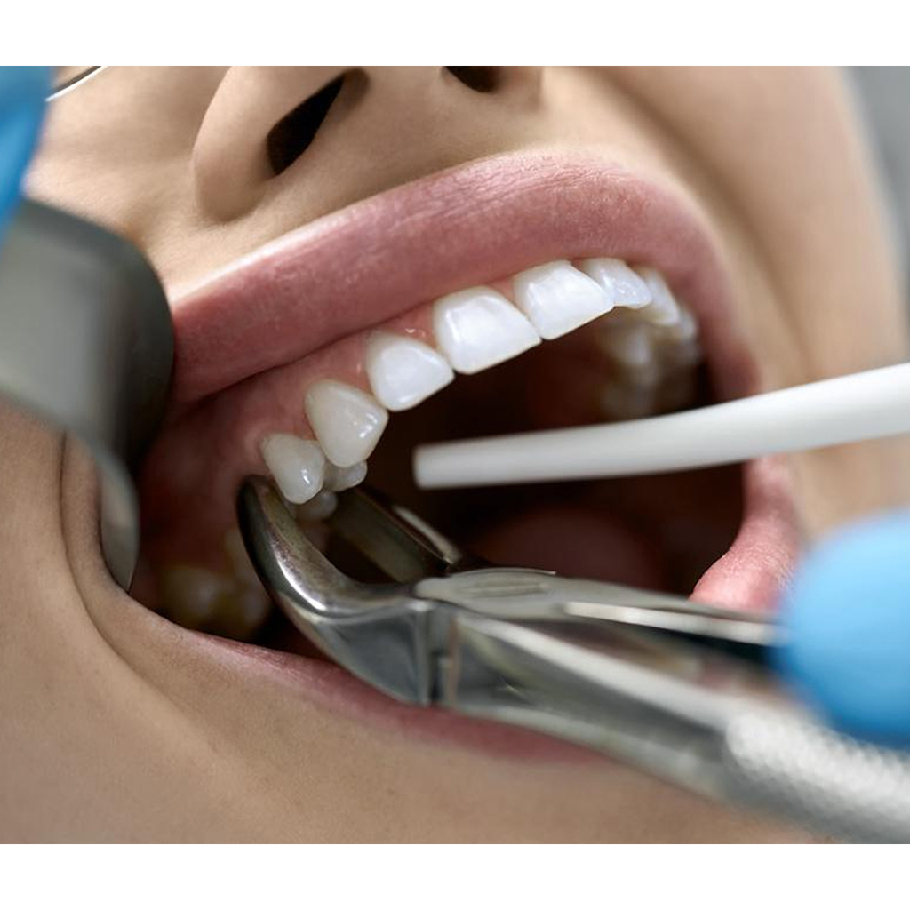 GDC Extraction Forceps Upper Premolars Pedo Standard (FX4CS)