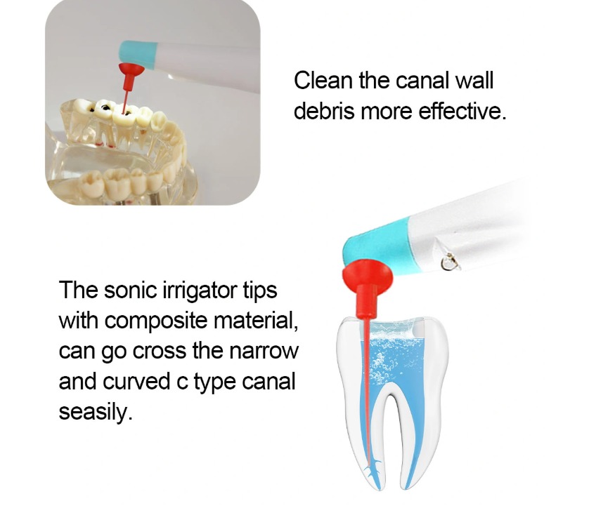 SuperEndo Tips For Sonic Irrigator (Pack of 10)