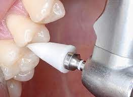 Youdent Silicone Polishers For Composite White (Pack Of 25)