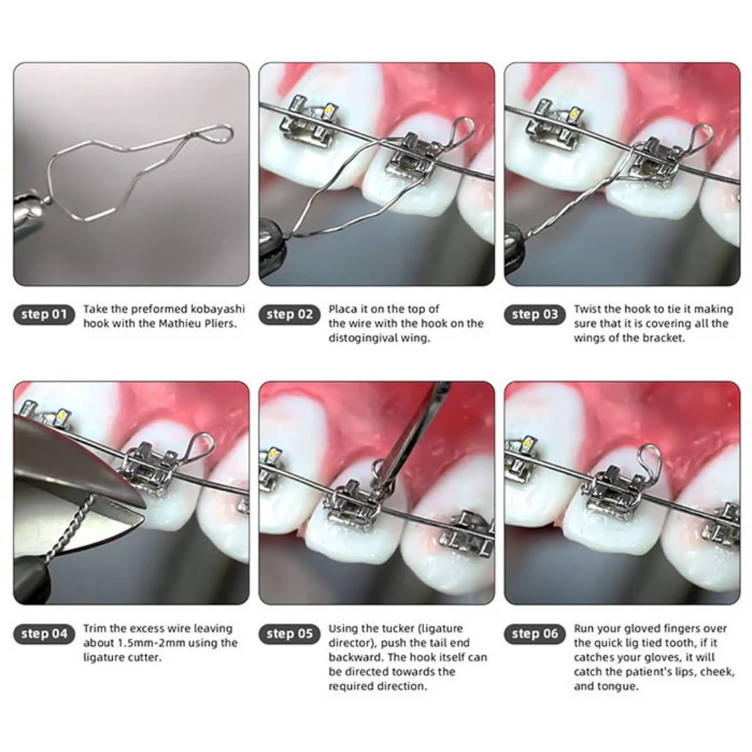 UU Ortho Kobayashi Ligature Wire 15.5cm (Pack of 100)