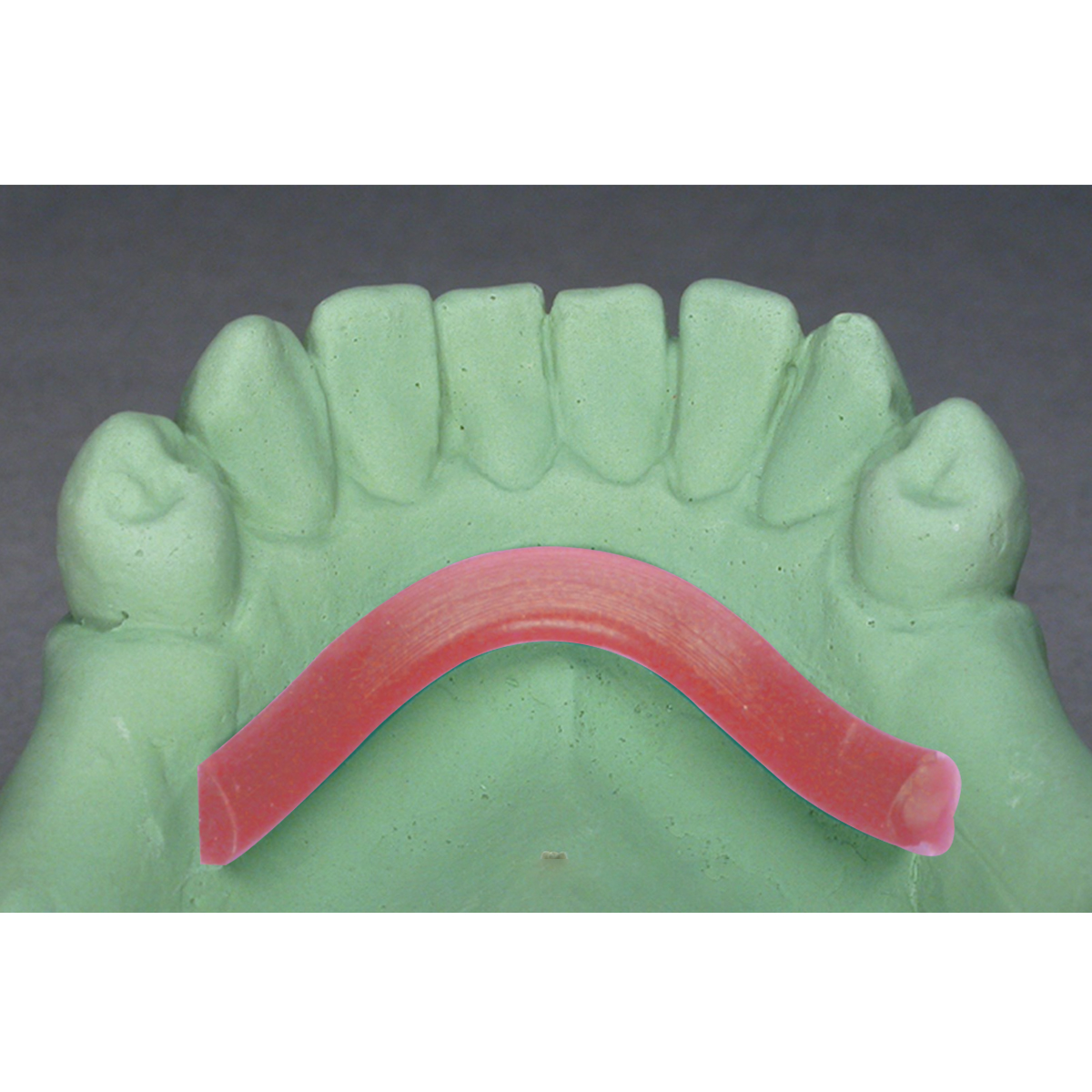 Maarc Lingual Bar Base Plate Wax