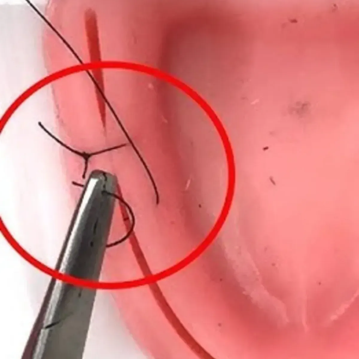 Ethicon Ethilon Sutures USP 4-0, 3/8 Circle Cutting Ethiprime